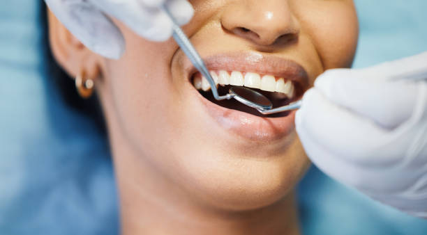 Best Pediatric Emergency Dentist in East Speer, NC