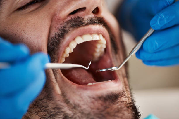 Best After-Hours Dental Trauma Care in East Speer, NC