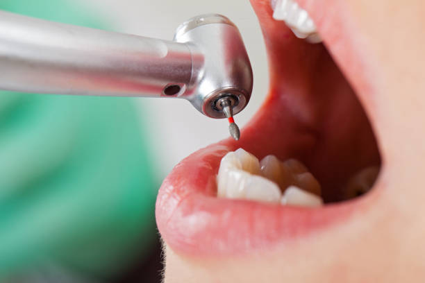 Best Weekend Emergency Dentist in East Speer, NC